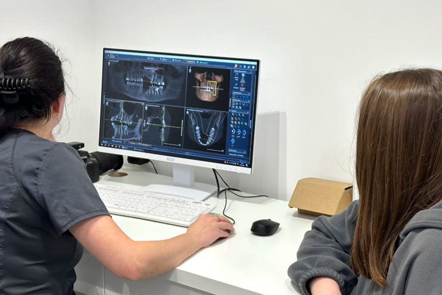 Імплантація зубів на Борщагівці в Luka Dental Clinic — сучасне відновлення зубів без болю